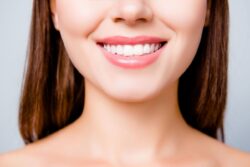 teeth whitening treatment Severna Park Maryland